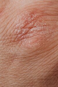 skin problems