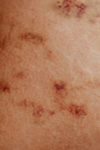 skin problems
