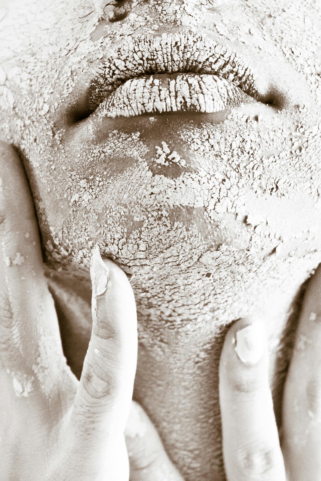 dry skin